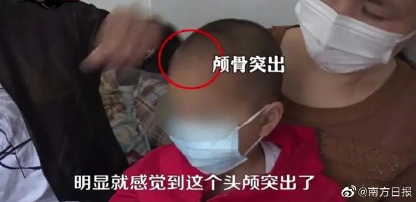 连线郴州“奶粉”事件家长：孩子两岁半还走不稳，担心长大会有后遗症